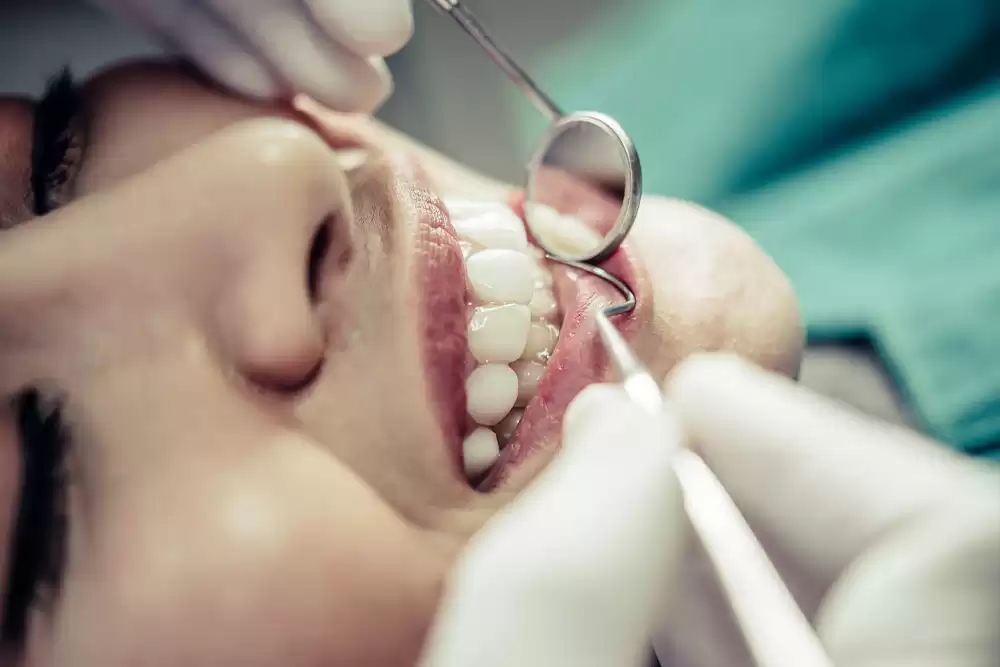 Full Mouth Rehabilitation